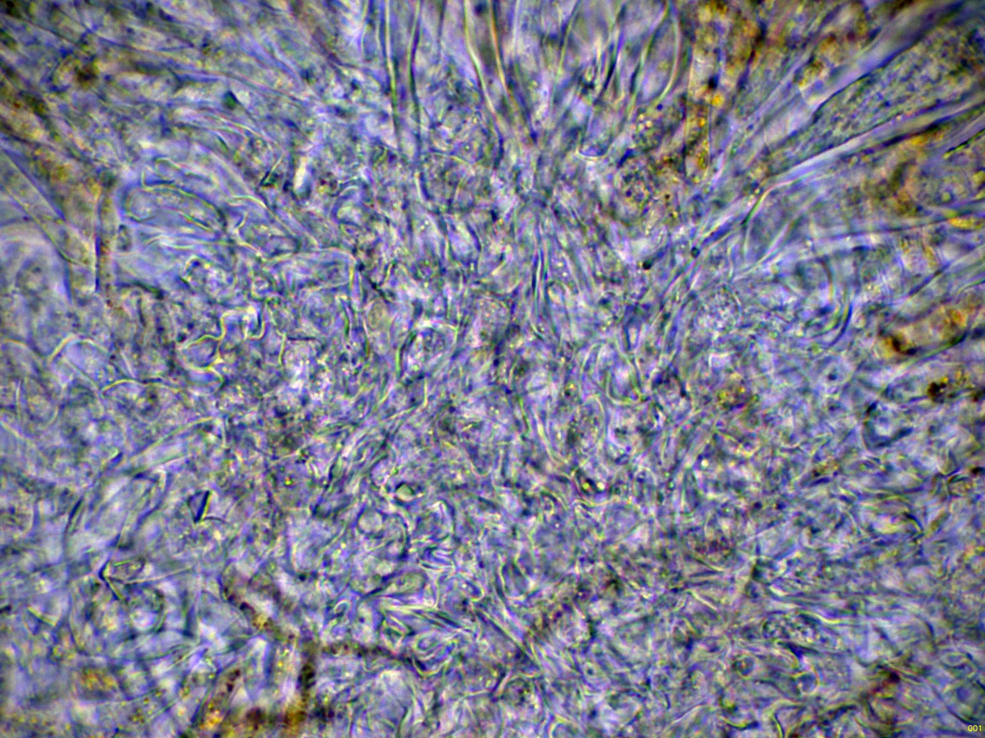 Microscopía de Octospora gemmicola - 11 - Excípulo agua-001
